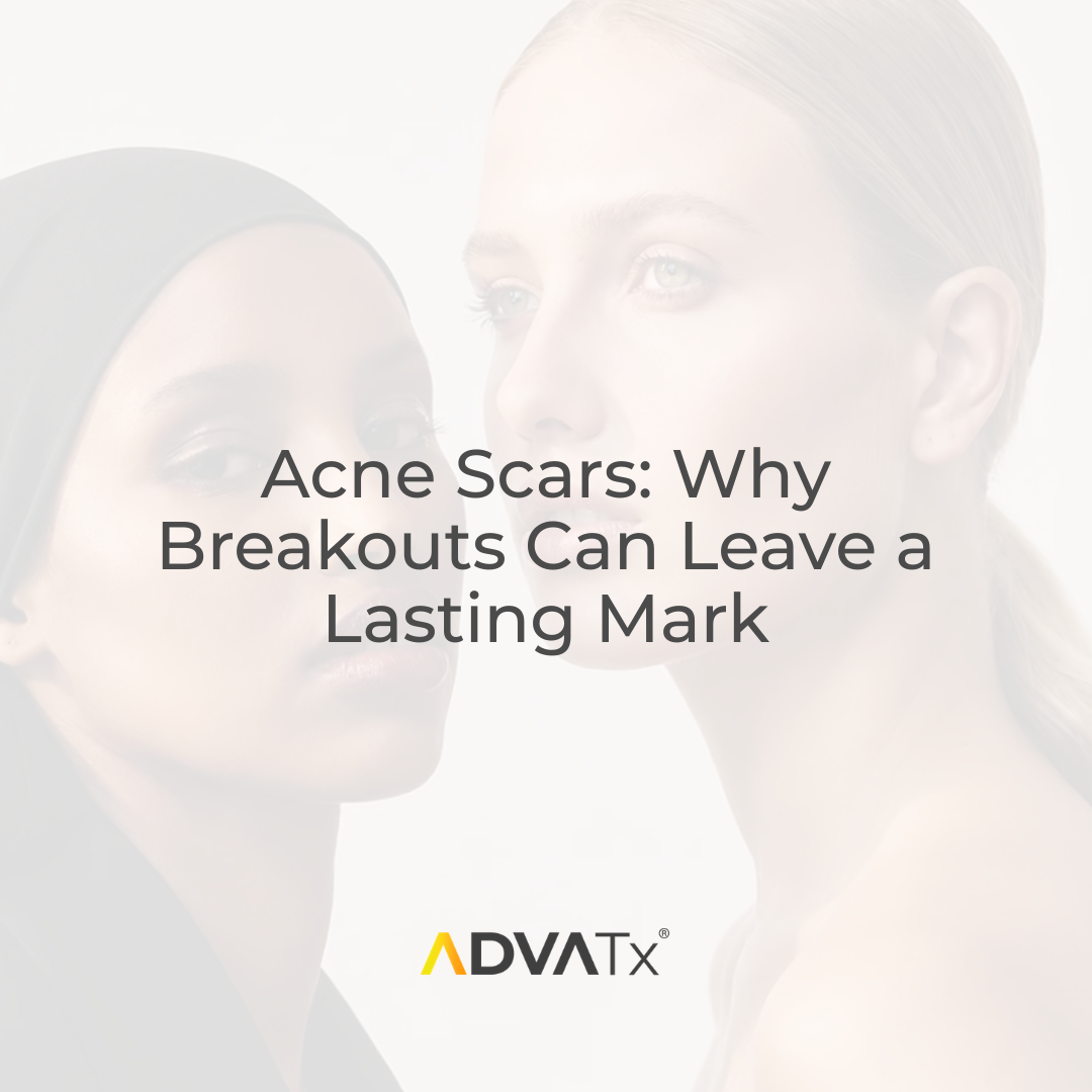 Acne Scars: Why Breakouts Can Leave a Lasting Mark