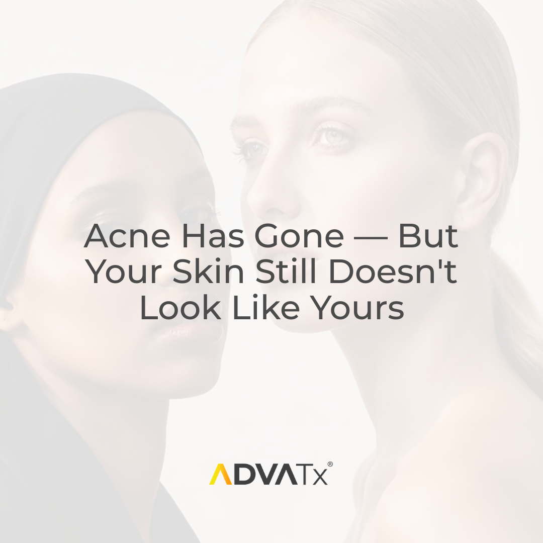 Acne Has Gone — But Your Skin Still Doesn't Look Like Yours