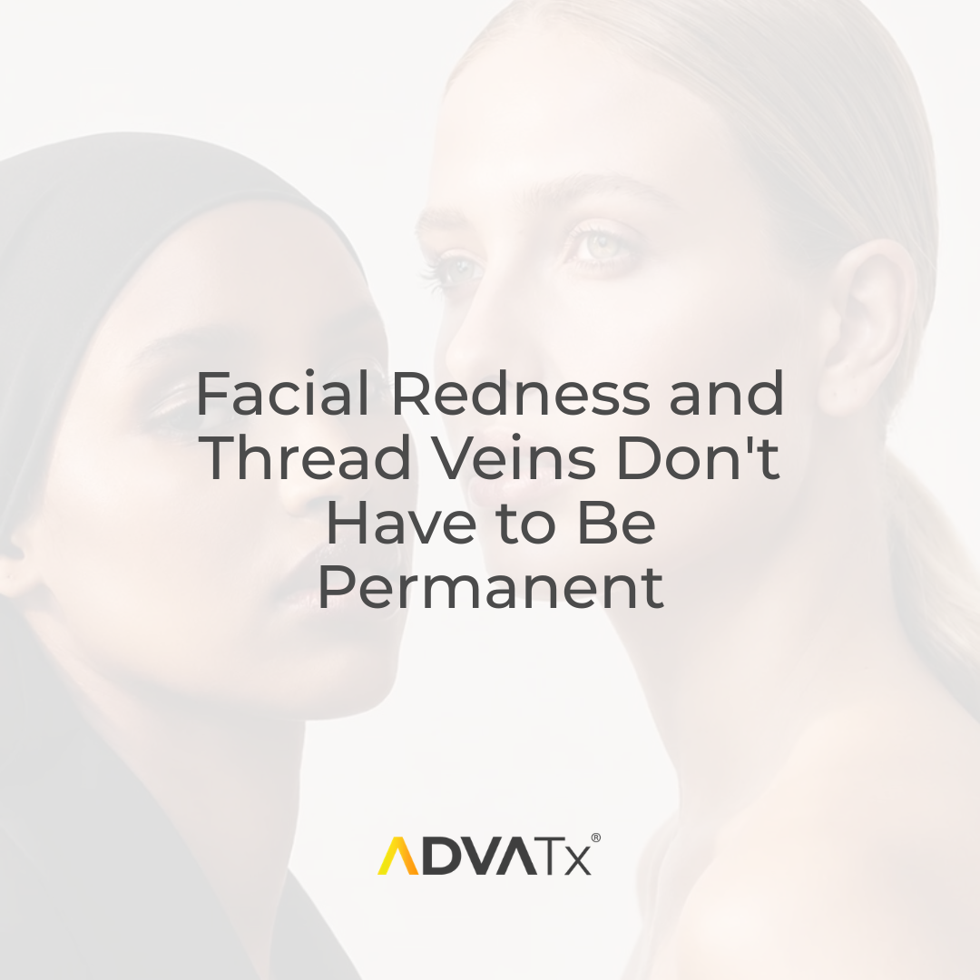 Facial Redness and Thread Veins Don't Have to Be Permanent